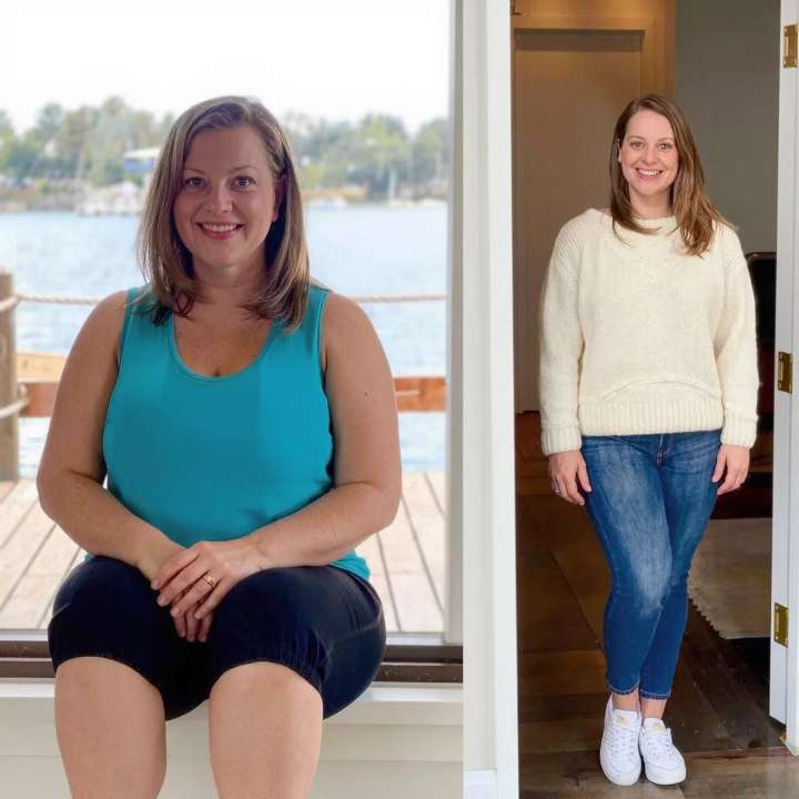 Nova Health and Wellness patient before and after