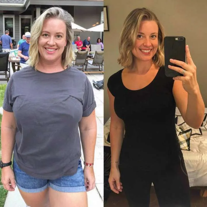 Nova Health and Wellness patient before and after